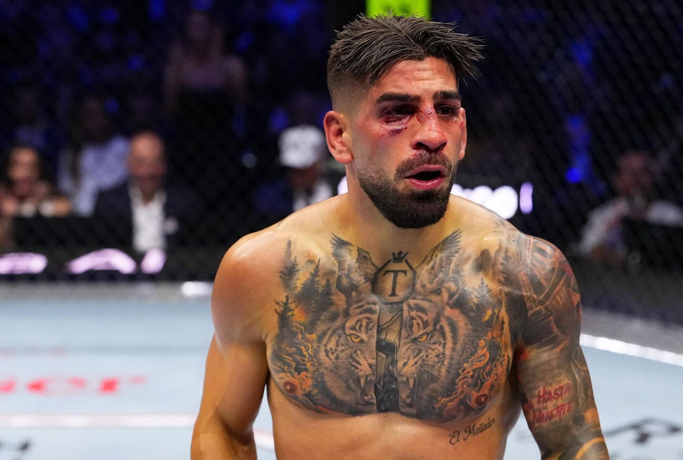 Ilia Topuria drew a 180-day medical suspension after his TKO loss to Justin Gaethje at UFC Freedom 250. Here are his injuries, return timeline and wha