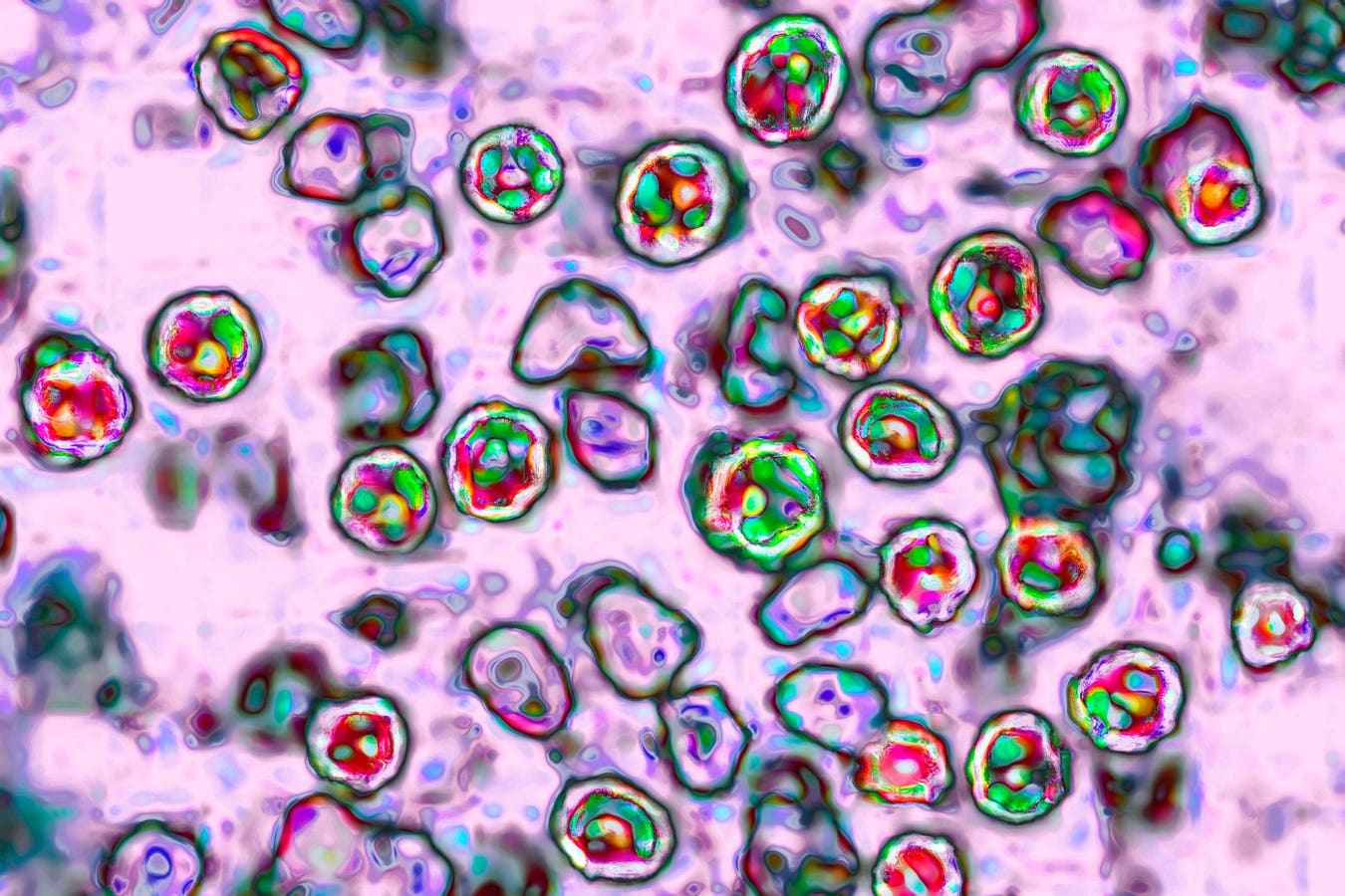 The U.S. is just a few dozen measles cases away from exceeding the number of cases recorded in 2025.